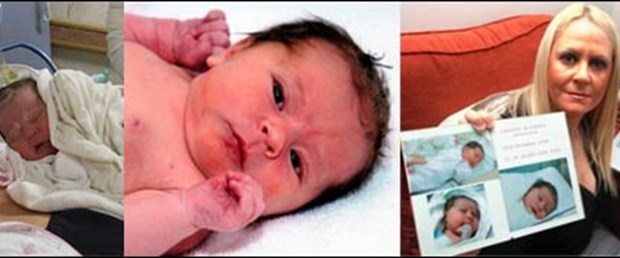 Bebek annesinden kaptığı herpes virüsüyle öldü