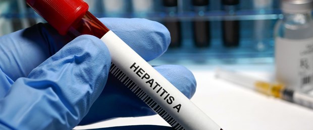 Hepatit virüsü DSàile ilgili görsel sonucu