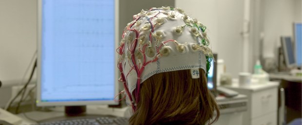 epilepsi 7.jpg