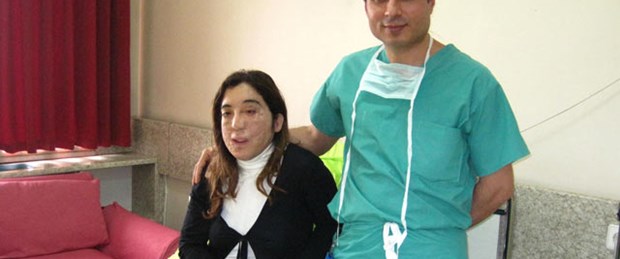 Güzellik uzmanının yüz nakli umudu