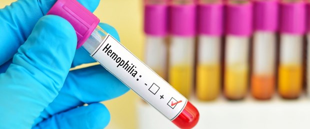 hemofili.jpg