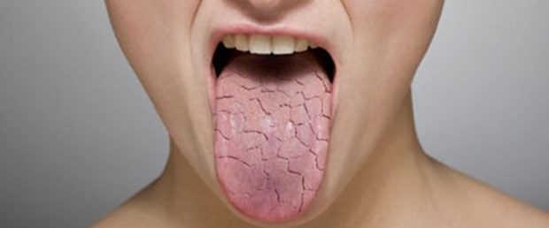 Kadınları tehdit eden sendrom Sjögren nedir.jpg