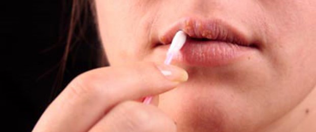 Kansere karşı herpes virüsü