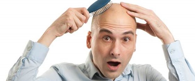 male-baldness.jpg