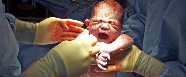 Küba, anneden bebeğe HIV geçişini önlemeyi başardı.jpg