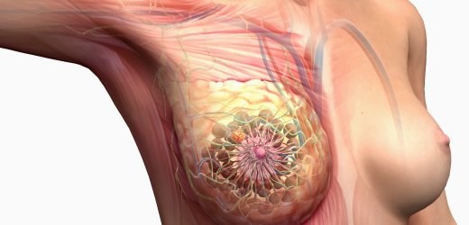 Meme cildinde yara veya kızarıklık