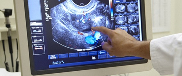 OBGYN_CervicalCancer.jpg