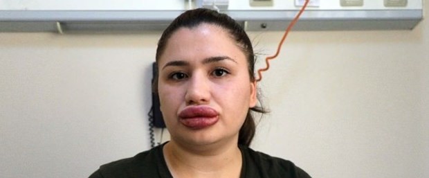 sahte_estetikci_merve_hemsireyi_sucladi_1499189130_1782.jpg