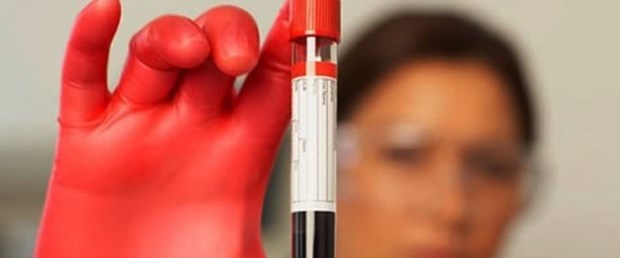 Talasemi riskini azaltmak için evlilik öncesi test şart.jpg