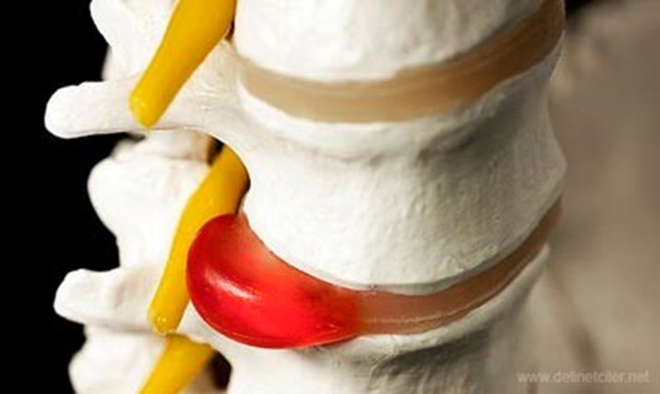 Sabit disk nedir Sabit disk nedir