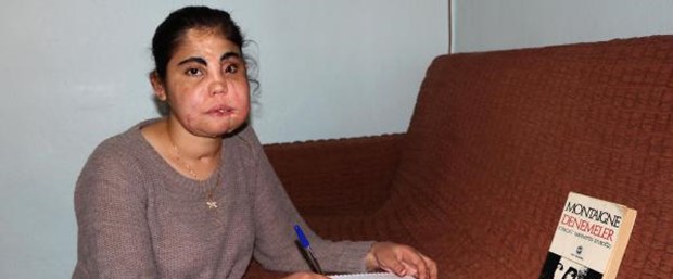 yüz nakli kadin.jpg