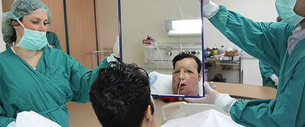 'Yeni yüzüm çok güzel olmuş'