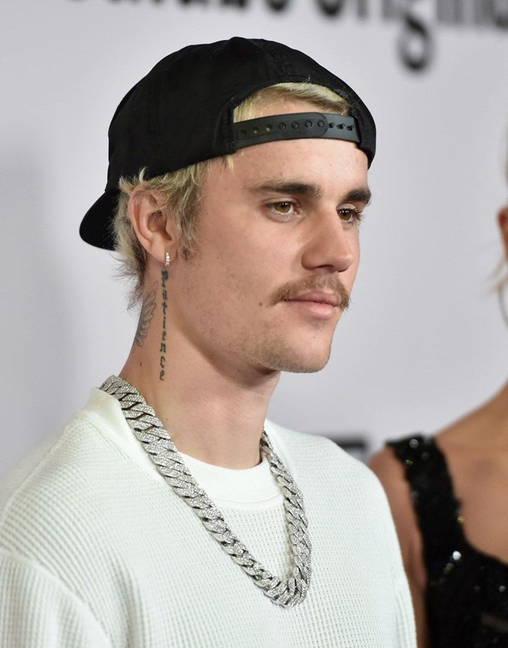 Justin Bieber nadir görülen bir sendrom nedeniyle yüz felci geçirdi - 7