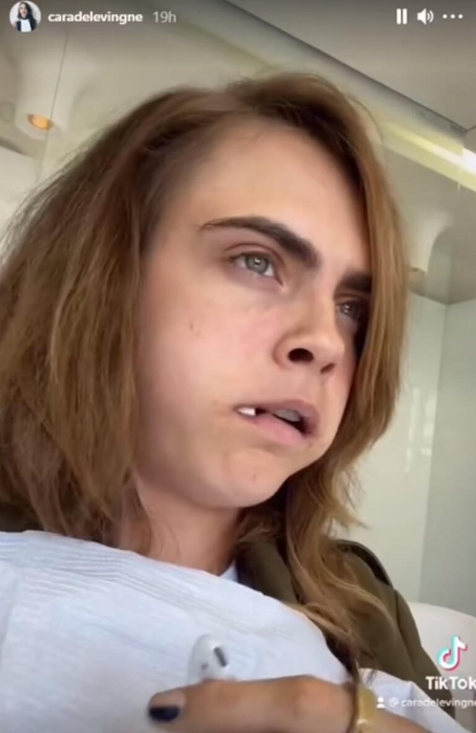 Cara Delevingne dişçi koltuğundan paylaştı: Çok ağladım - 1