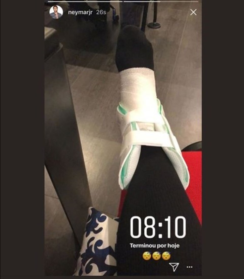 Neymar ayağının son durumunu sosyal medya hesabından paylaştı.
