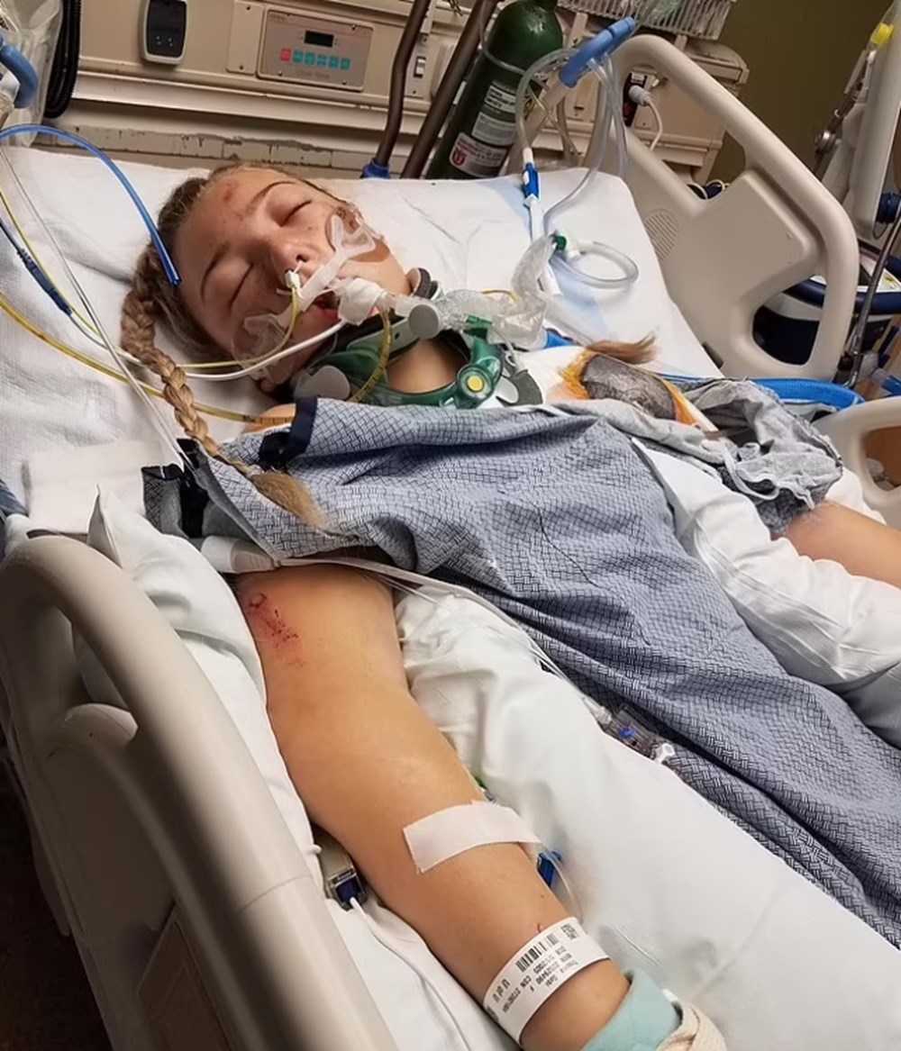 Trafik kazasında arabadan fırlayan genç kız elektrik tellerinde asılı kaldı - 2