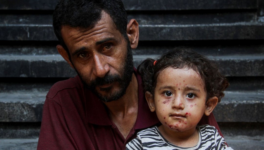 Gazze'nin çocuk kurbanları: Savaş, hastalık ve çaresizlik