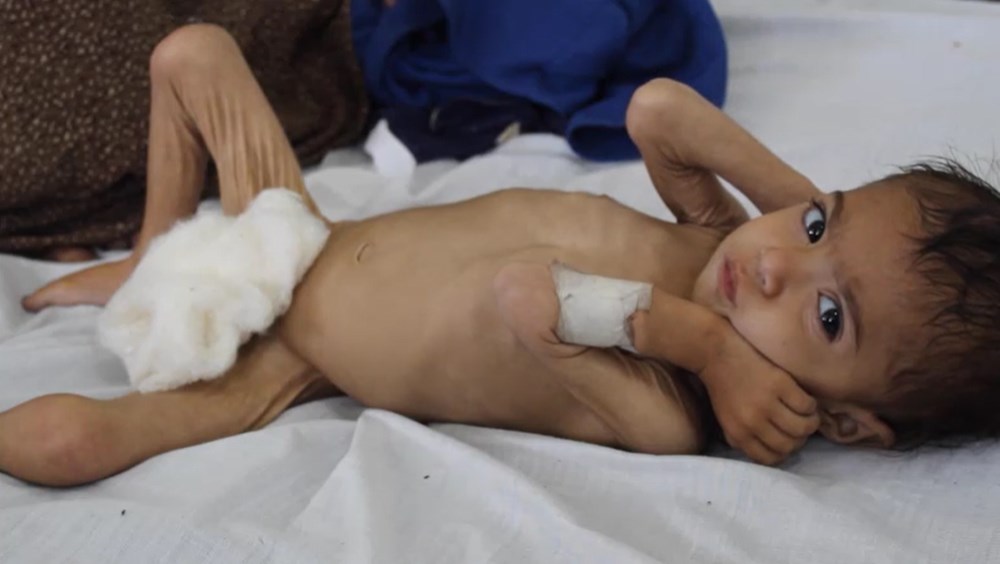 Afganistan'daki açlık krizinin acı yüzü: 3 yaşında ama bir bebek kadar küçük - 1