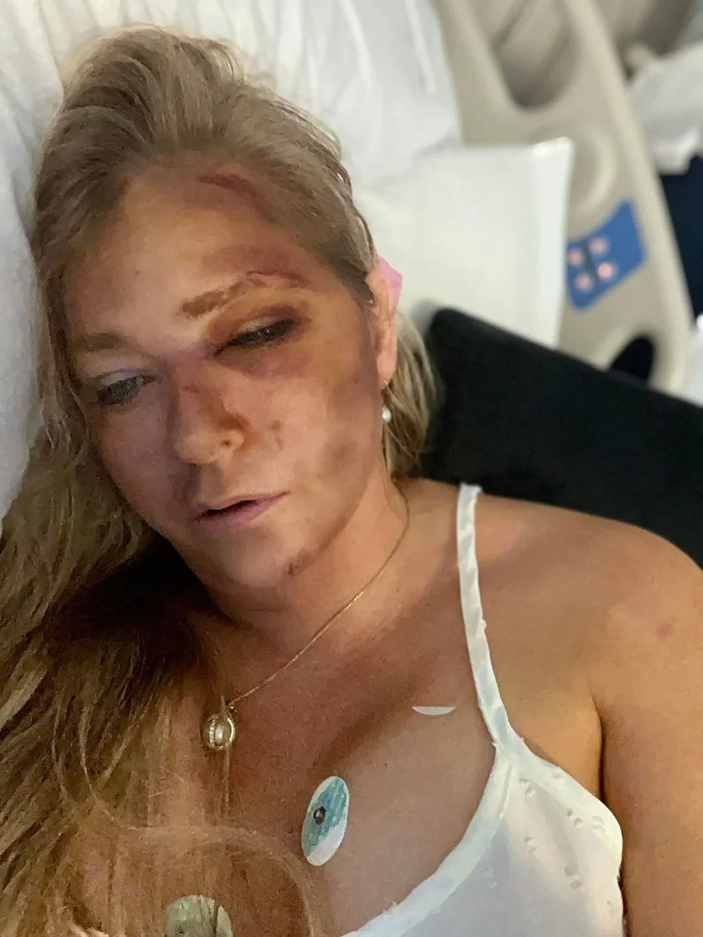 Pedofili milyarder Epstein kurbanı bayan kaza geçirdi! "Sayılı günüm kaldı" 73 tYyjJ9WK90yIZwSgujaFLw