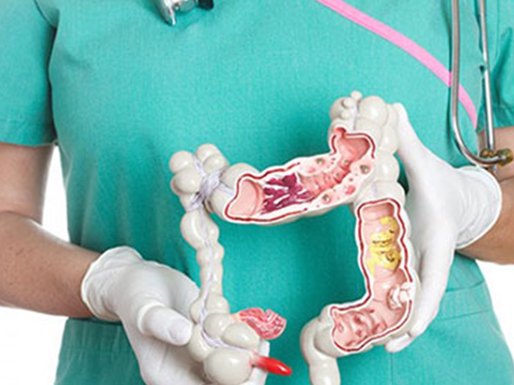 kanserine yol acan 7 etken