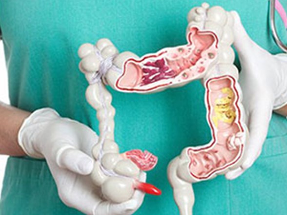 kanserine yol acan 7 etken