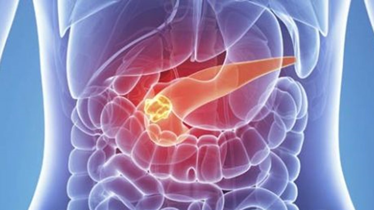 pankreas kanseri en sinsi kanser turu