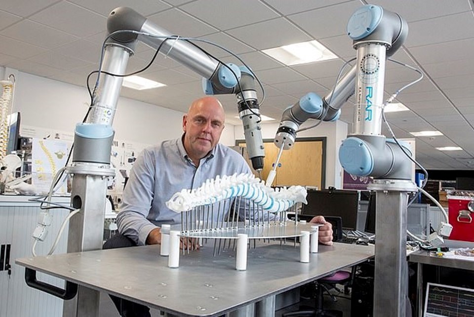 İngiliz basınına konuşan Profesör Phillip Breedon robotun skolyoza ameliyatında bugüne kadar kayıt edilen tüm derecelerden daha iyi sonuç elde ettiğinin altını çizdi.
