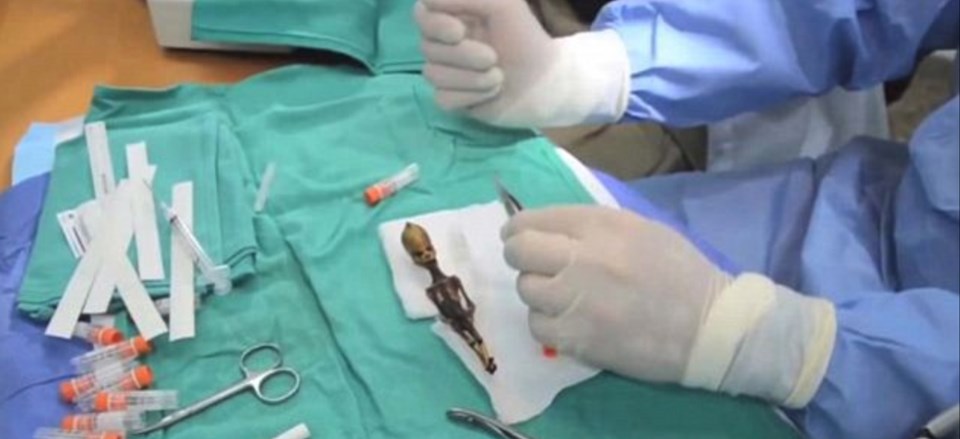 "Ata" the mummy, Mumya, Arkeoloji, Genetik, Şili, Dünya, Bilim