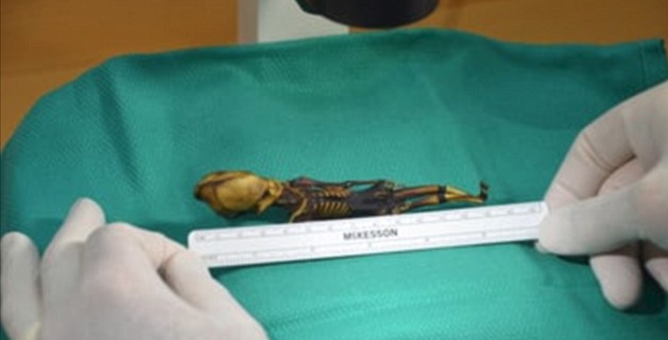 "Ata" the mummy, Mumya, Arkeoloji, Genetik, Şili, Dunya, Bilim