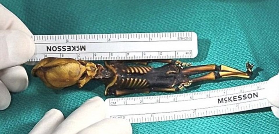 "Ata" the mummy, Mumya, Arkeoloji, Genetik, Şili, Dunya, Bilim