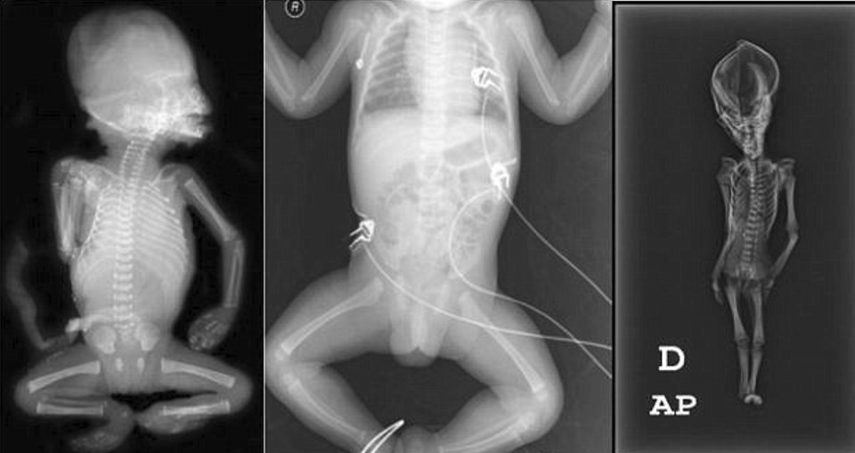 "Ata" the mummy, Mumya, Arkeoloji, Genetik, Şili, Dünya, Bilim