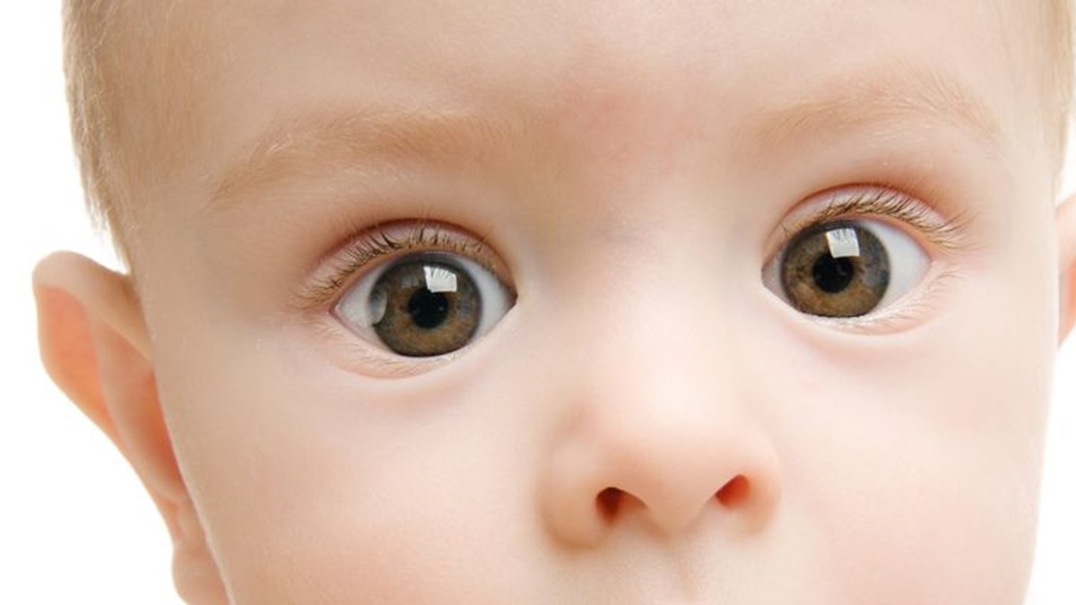 Sasilik Tedavisi Ihmale Gelmez Cocugunuzdaki Goz Kaymasi Gozunuzden Kacmasin Saglik Haberleri Ntv