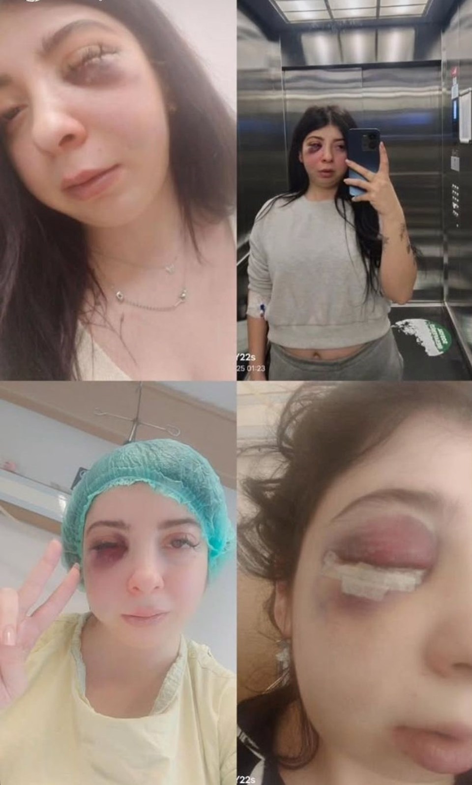 Sokak ortasında tacize uğrayıp dayak yiyen Damla'nın isyanı - 1