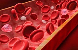 Kansizlik Kalp Ritim Bozuklugunu Tetikleyebilir Saglik Haberleri Ntv