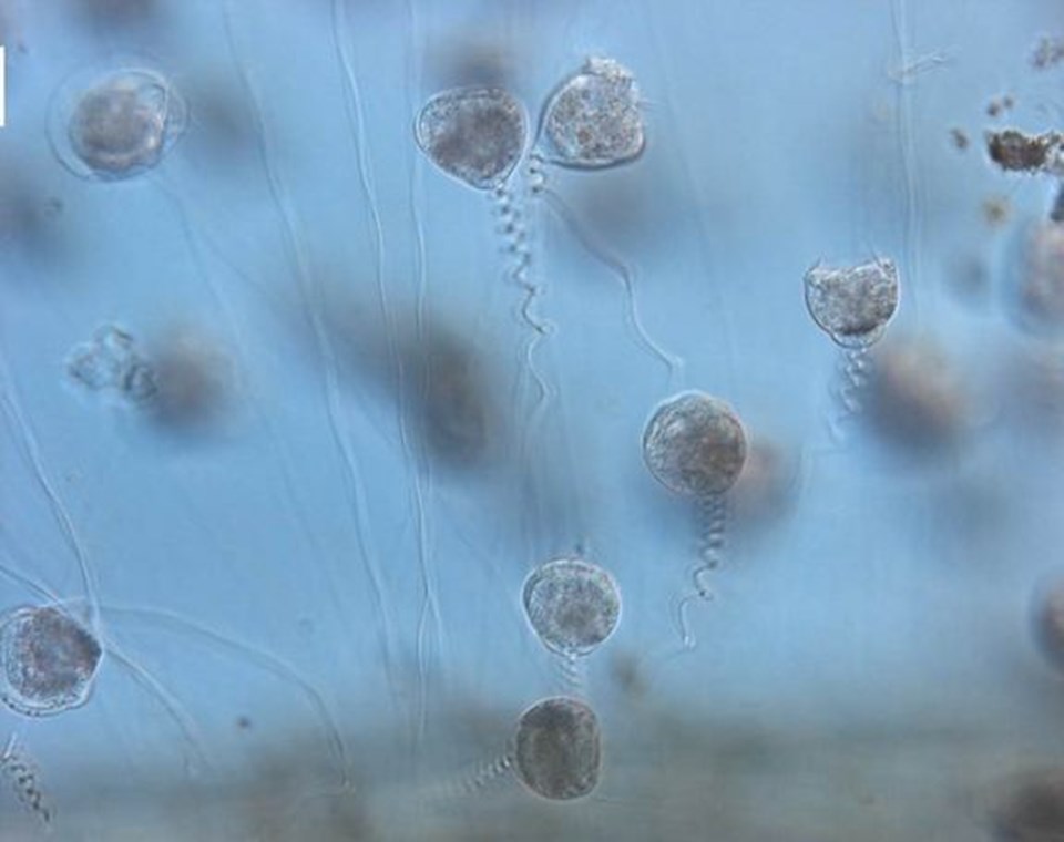 Vorticella.