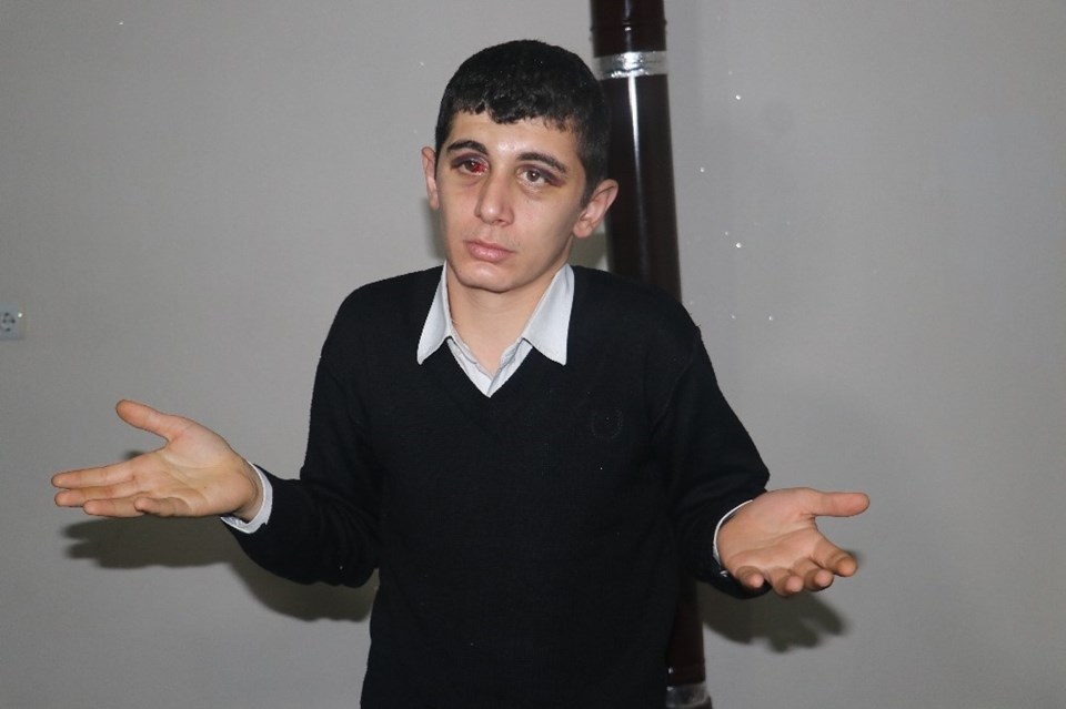 Darp edilen Agit Acun hastaneden rapor aldı.