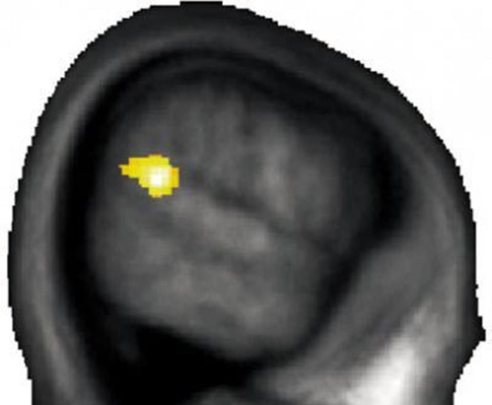 Parietal ve temporal lobun kesişimi olan bölge.