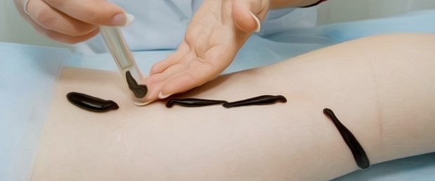 Sülük tedavisinde hepatit riski uyarısı.jpg