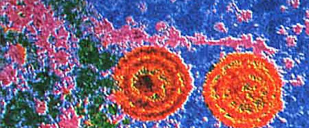 Kansere karşı Herpes virüsü