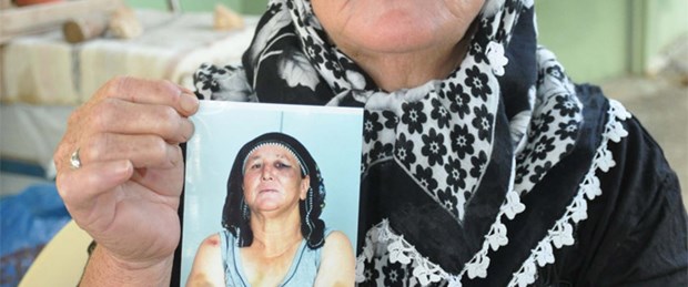 Koca şiddetinin izlerini fotoğrafladı