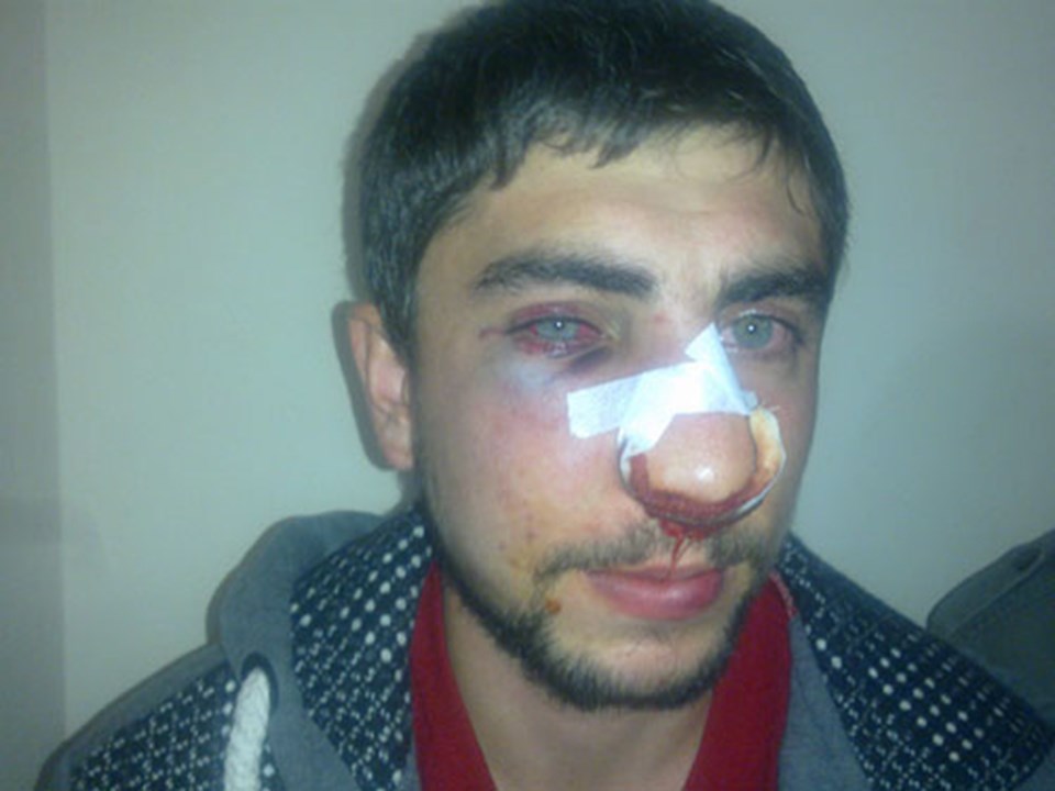 Öğrenciler, Kuzu'yu protesto sırasında hafta sonu polisin müdahalesinde yaralanan Miraç Efe'nin posterini açtı.