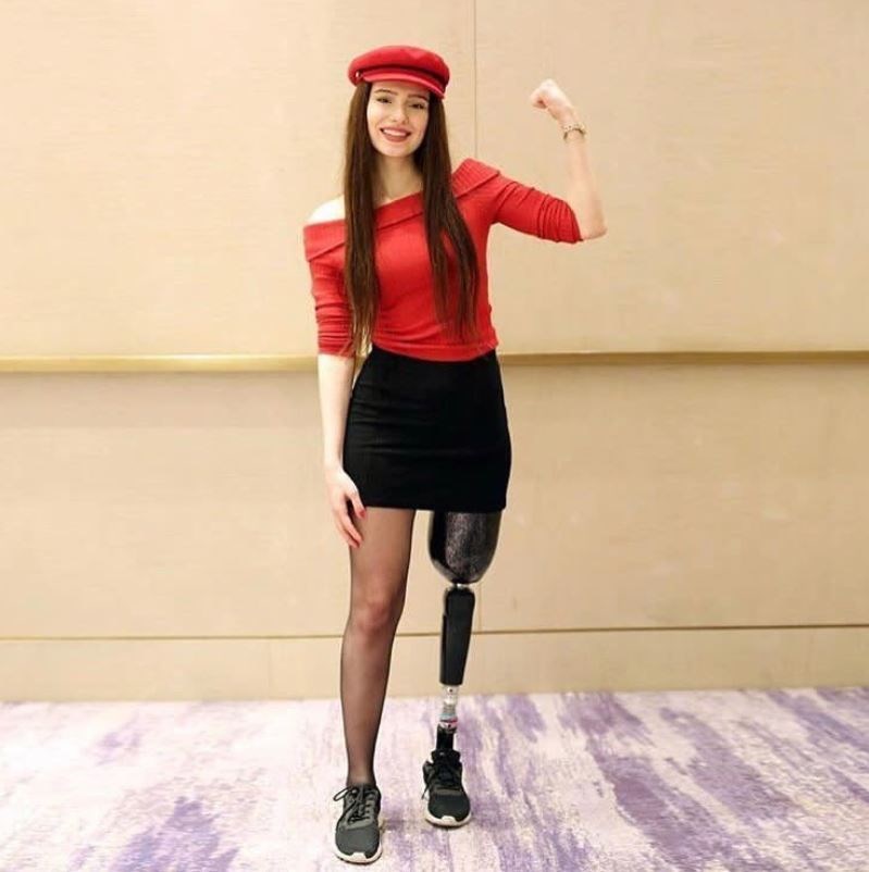 KESİLEN BACAĞININ GÖMÜLDÜĞÜ YERDE TOPRAĞA VERİLDİ