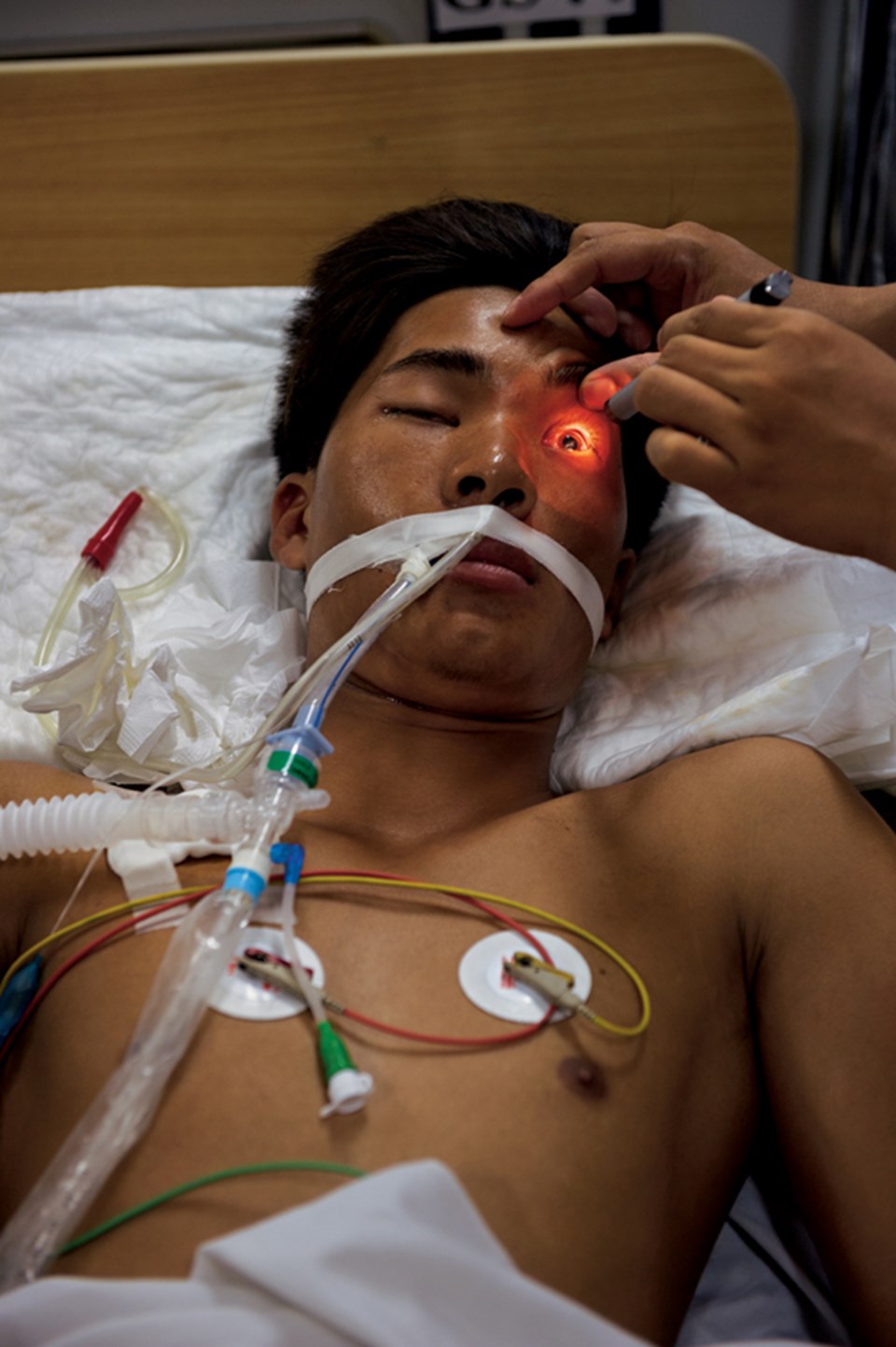 Vietnam kırsalındaki evinde uyurken zehirli bir krait yılanı tarafından sokulan Can Van Thanh (20), Hanoi’deki Bach Mai hastanesinde paralize halde yatıyor.Takacs’ın ekibinin Tayland’dan panzehir getirtmesinden sonra kurtuldu.