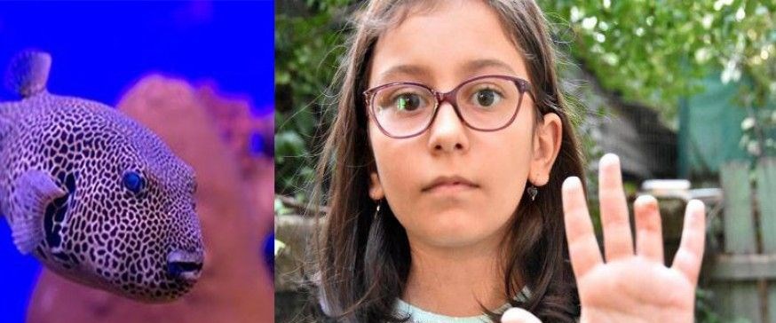 Balon balığı parmağını kopardı (Küçük kız o anları anlattı ...