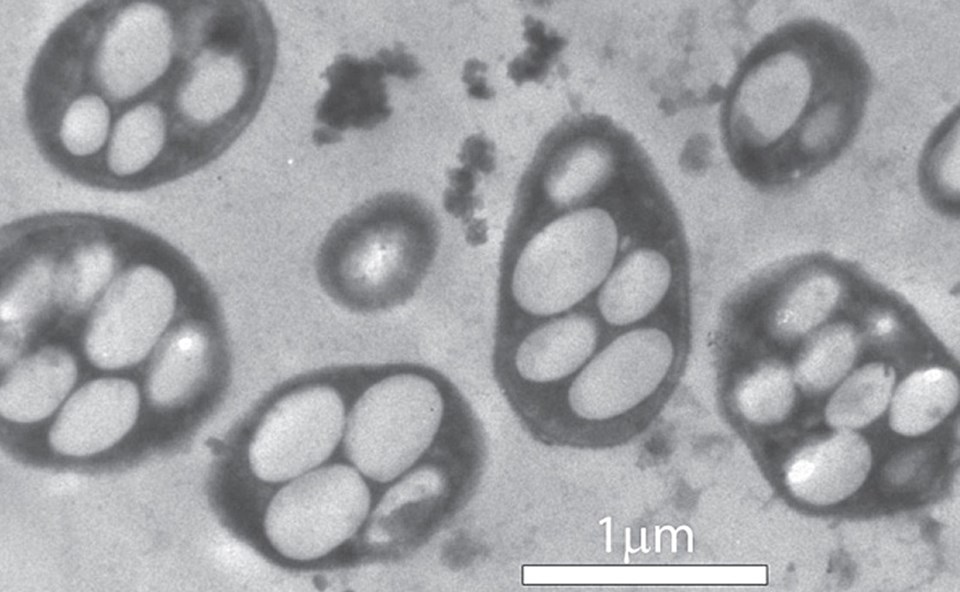 Halomonadaceae ailesine ait GFAJ-1 soyu bakteriler, DNA'larında fosfor elementi yerine arsenik bağlayabiliyor.