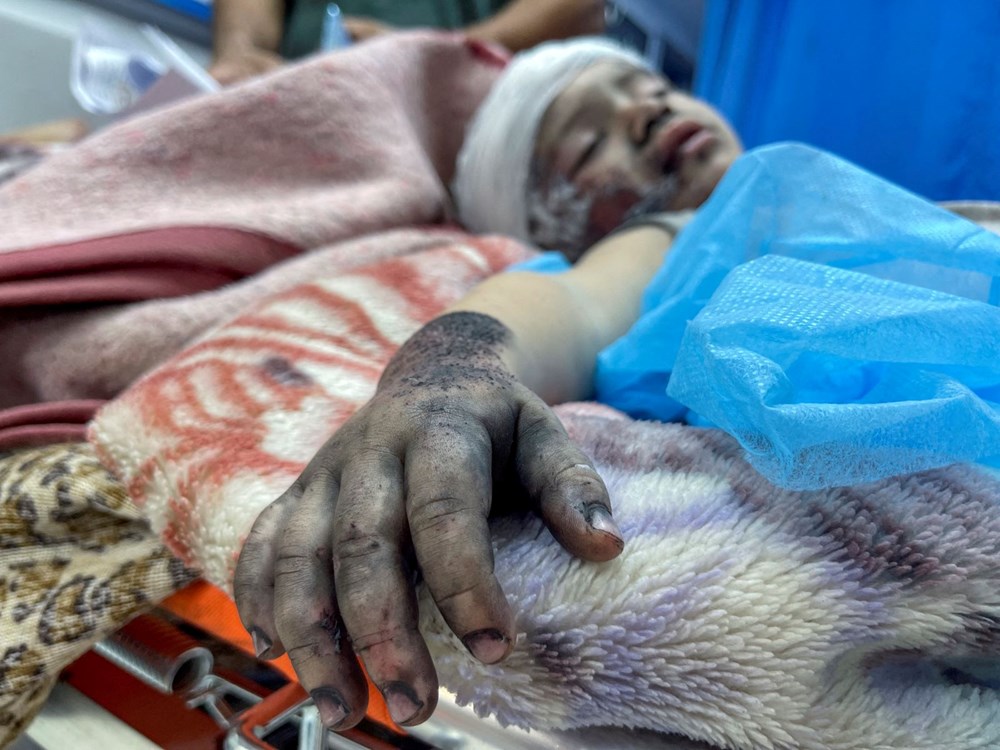 İnsanı dram her geçen gün derinleşiyor! (İsrail-Hamas çatışmalarında 10. gün) - 5