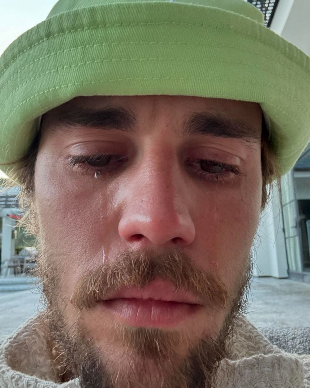 Justin Bieber'ın o fotoğrafları hayranlarını endişelendirdi - 2
