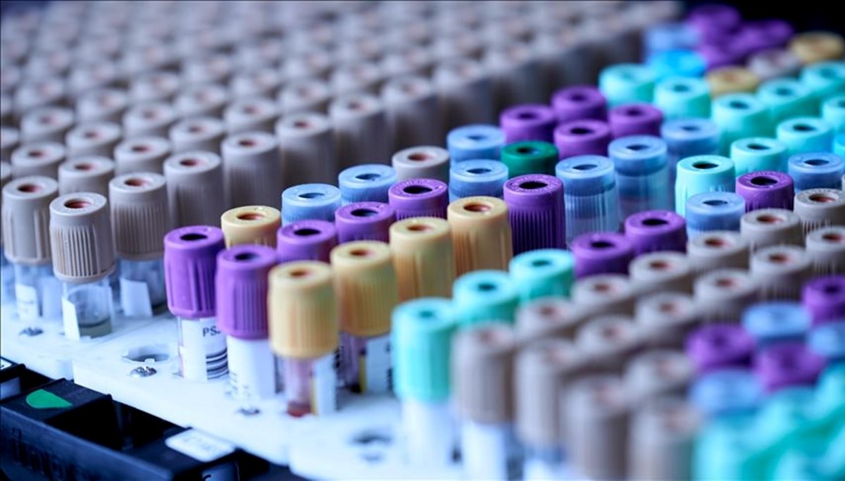 Dünyada gizemli hepatit vakaları 228'e yükseldi