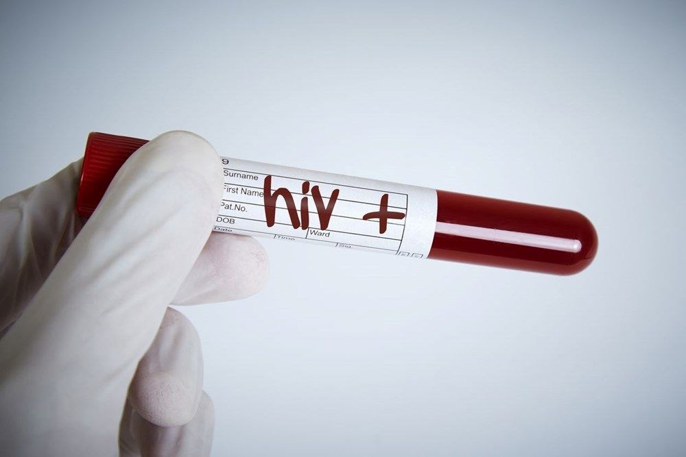 AIDS'in kesin tedavisinde önemli gelişme: HIV taşıyan makaklar kök hücre nakliyle tedavi edildi - 8