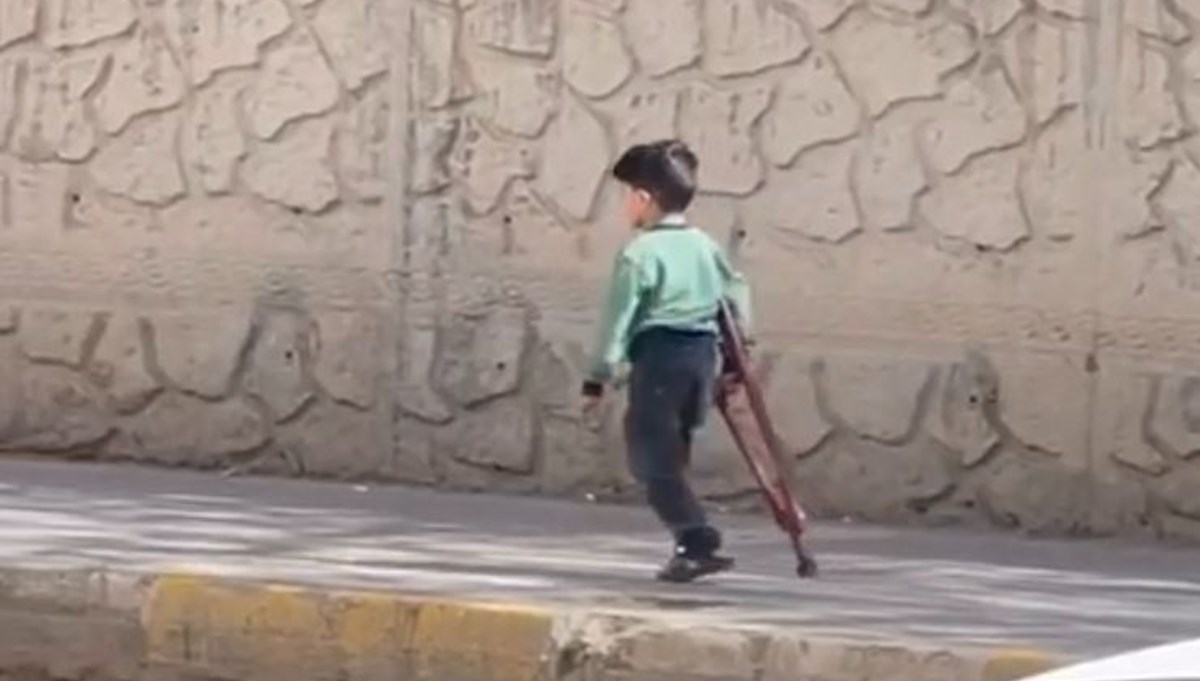 Sosyal medyada çok konuşulmuştu: 3 yaşındaki Muhammet'e protez bacak